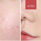 4 in 1 Soft Facial Cleansing Brush