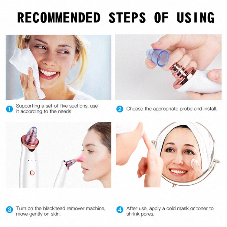 Facial Vacuum Blackhead & Acne Remover